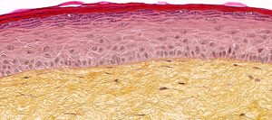 T-Skin Reconstructed Human Full Thickness model